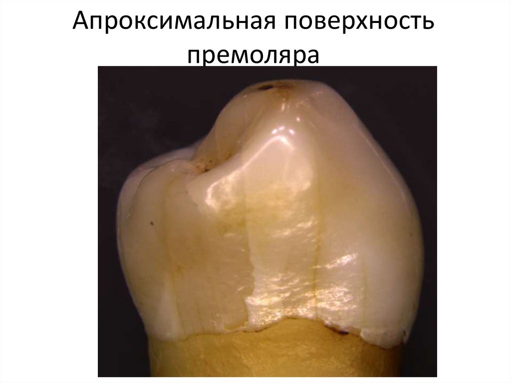 Апроксимальная поверхность премоляра