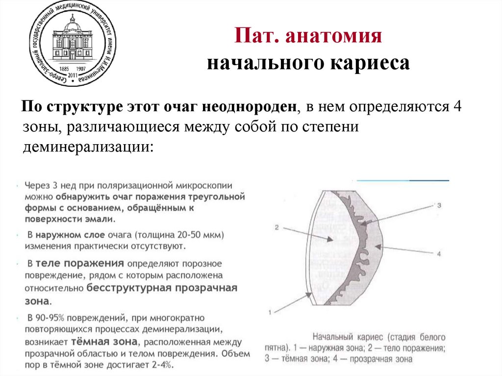 Пат. анатомия начального кариеса
