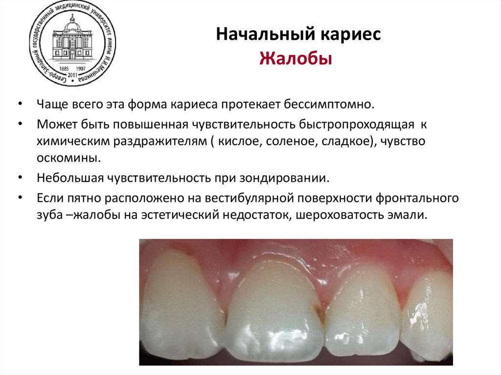 Начальный кариес Жалобы