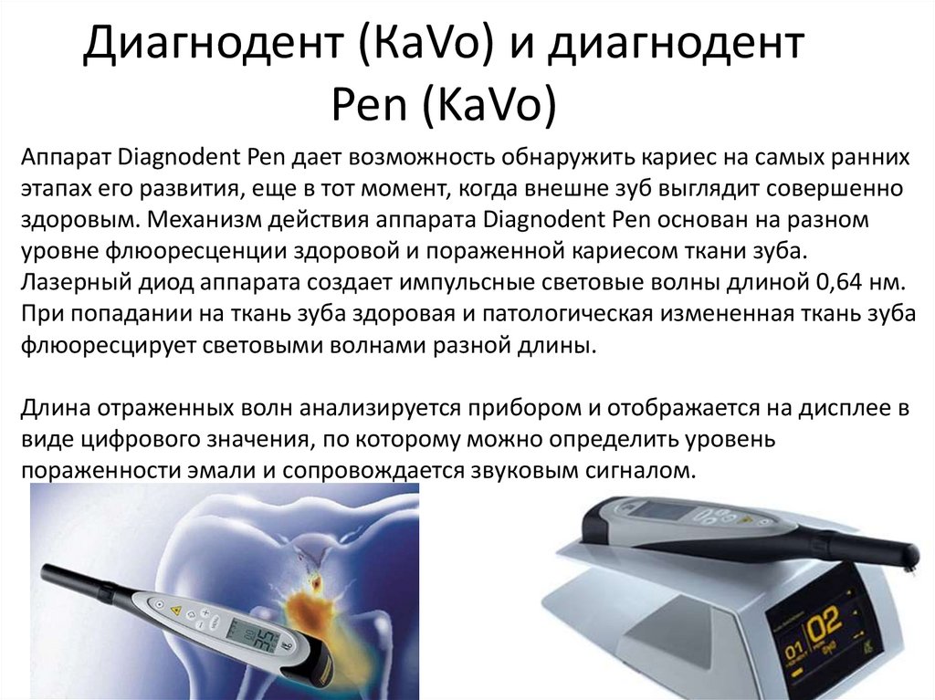 Диагнодент (КаVo) и диагнодент Pen (KaVo)