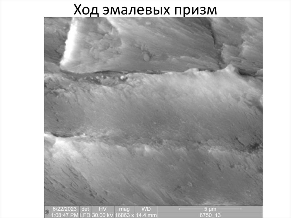 Ход эмалевых призм