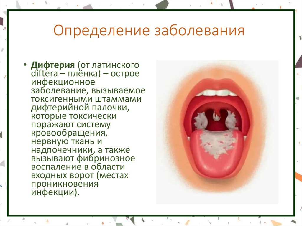 Определение заболевания