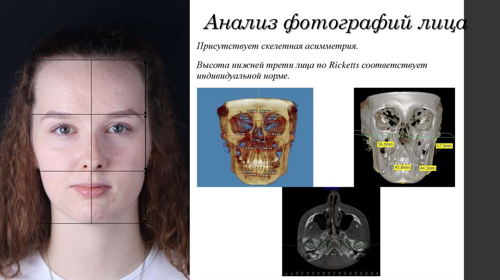 Анализ фотографий лица