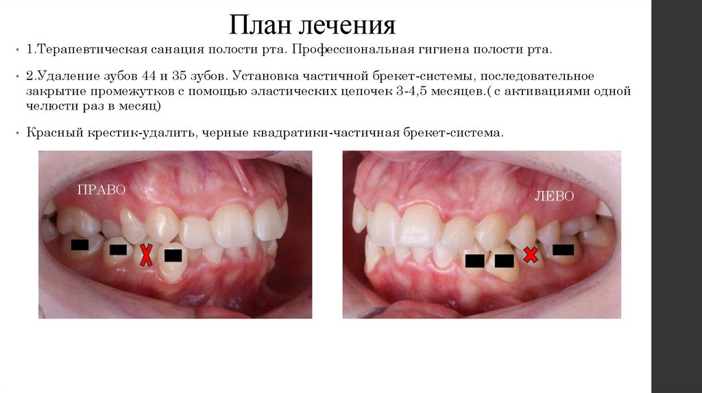 План лечения
