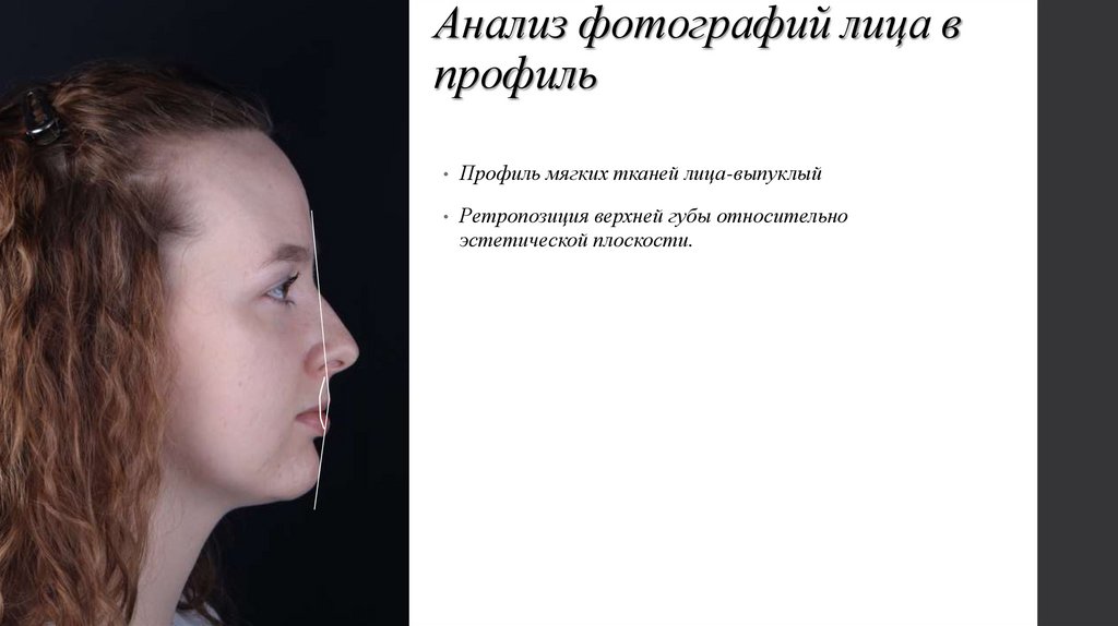 Анализ фотографий лица в профиль