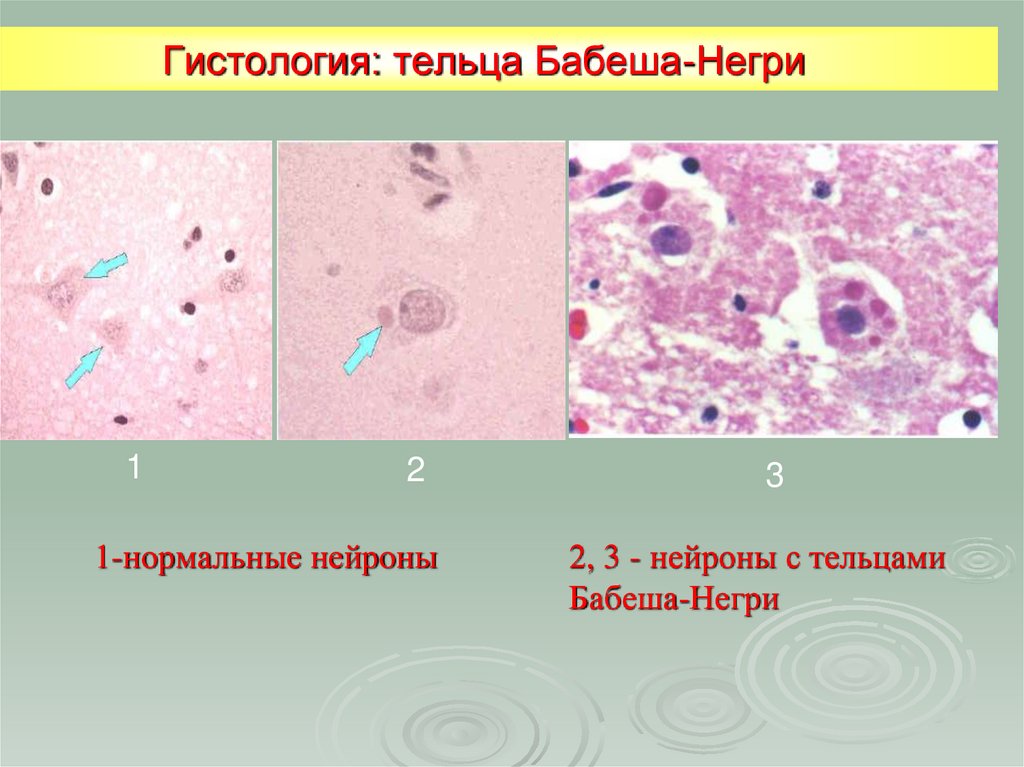 Гистология: тельца Бабеша-Негри