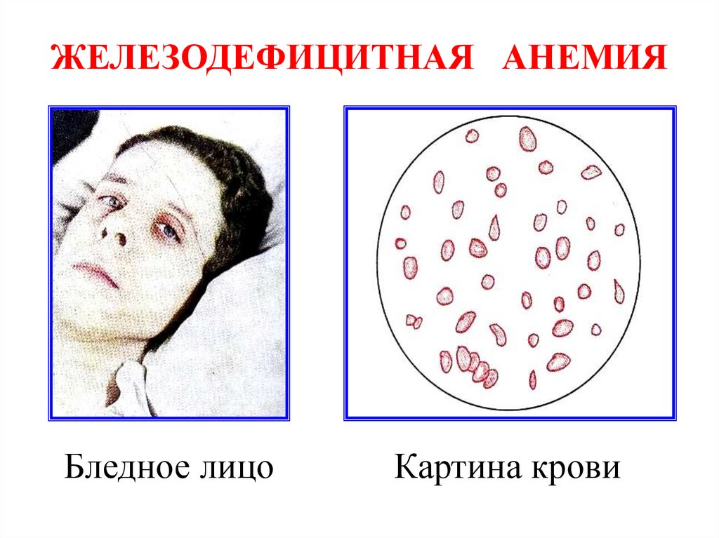 Бледное лицо