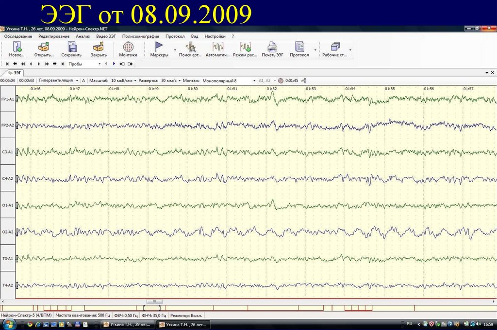 ЭЭГ от 08.09.2009
