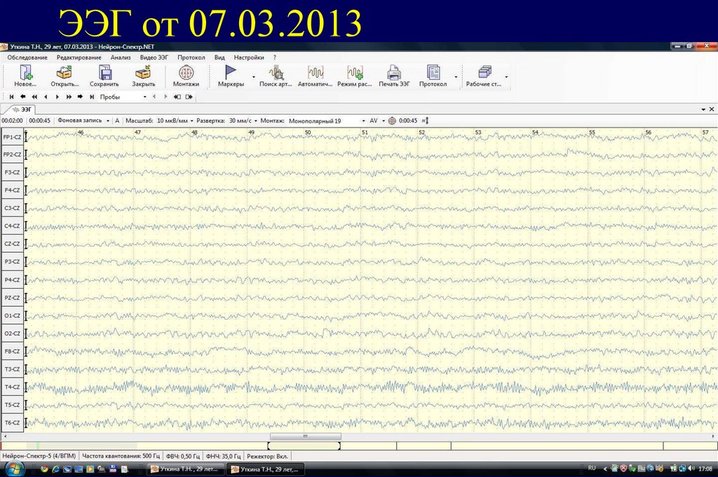 ЭЭГ от 07.03.2013