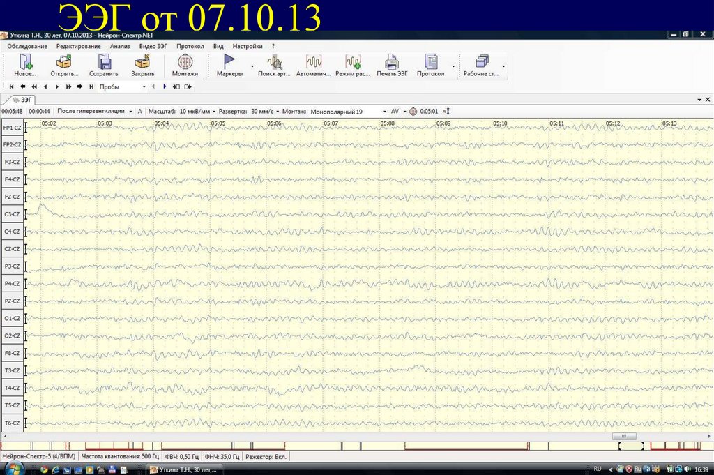 ЭЭГ от 07.10.13