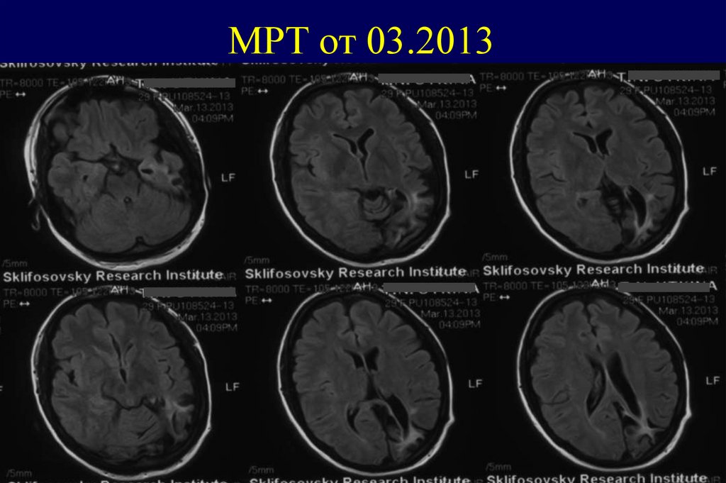 МРТ от 03.2013