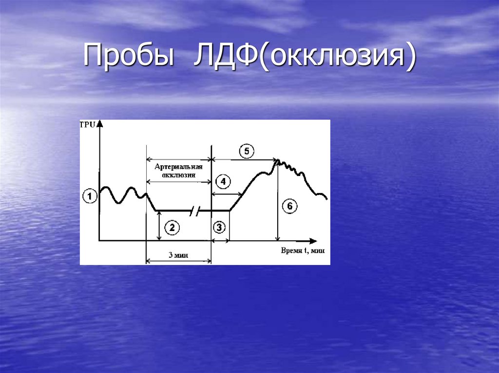 Пробы ЛДФ(окклюзия)
