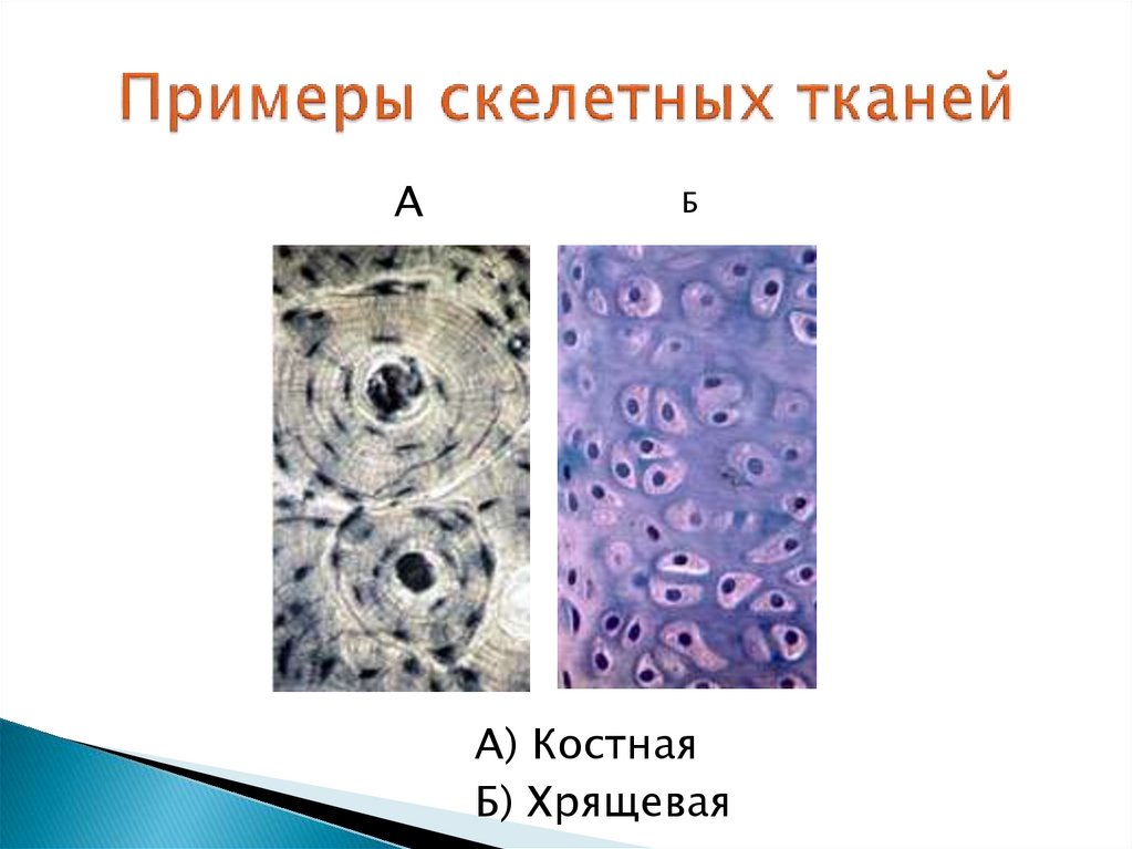 Примеры скелетных тканей