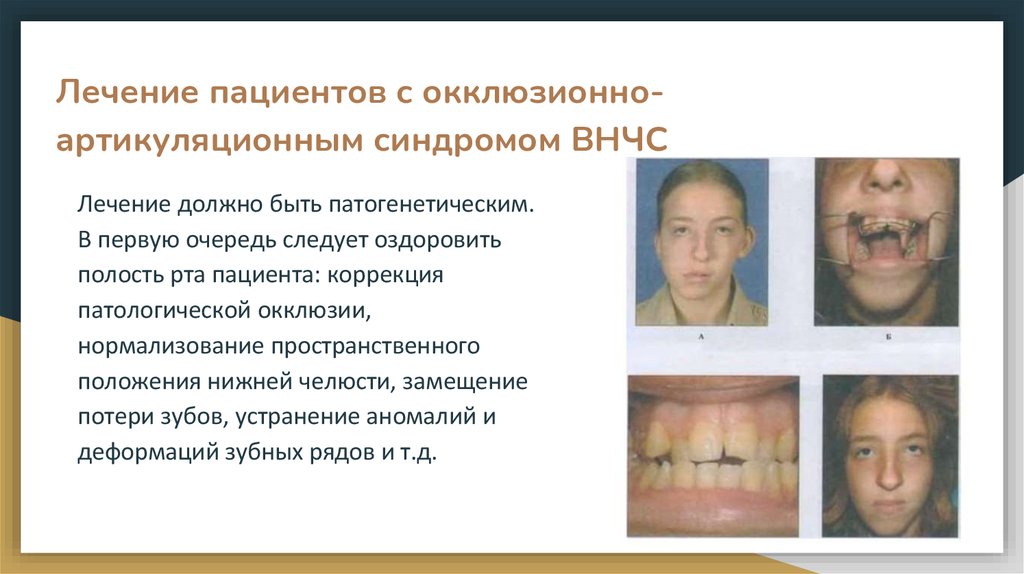 Лечение пациентов с окклюзионно-артикуляционным синдромом ВНЧС 