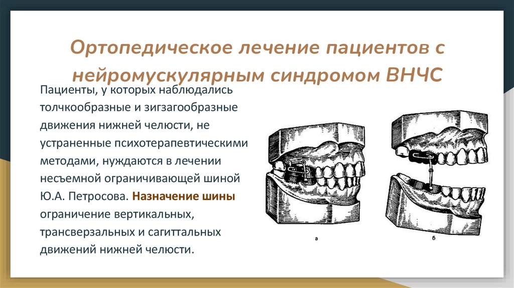 Ортопедическое лечение пациентов с нейромускулярным синдромом ВНЧС