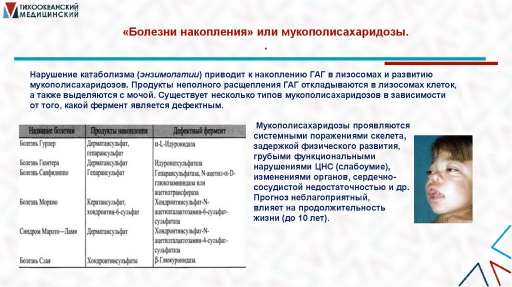 «Болезни накопления» или мукополисахаридозы. .
