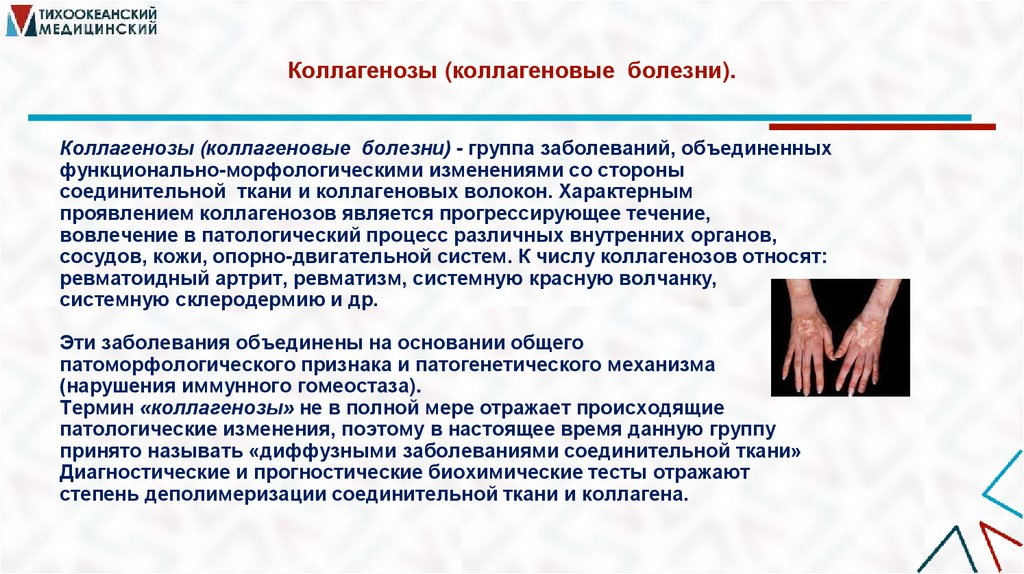 Коллагенозы (коллагеновые болезни).