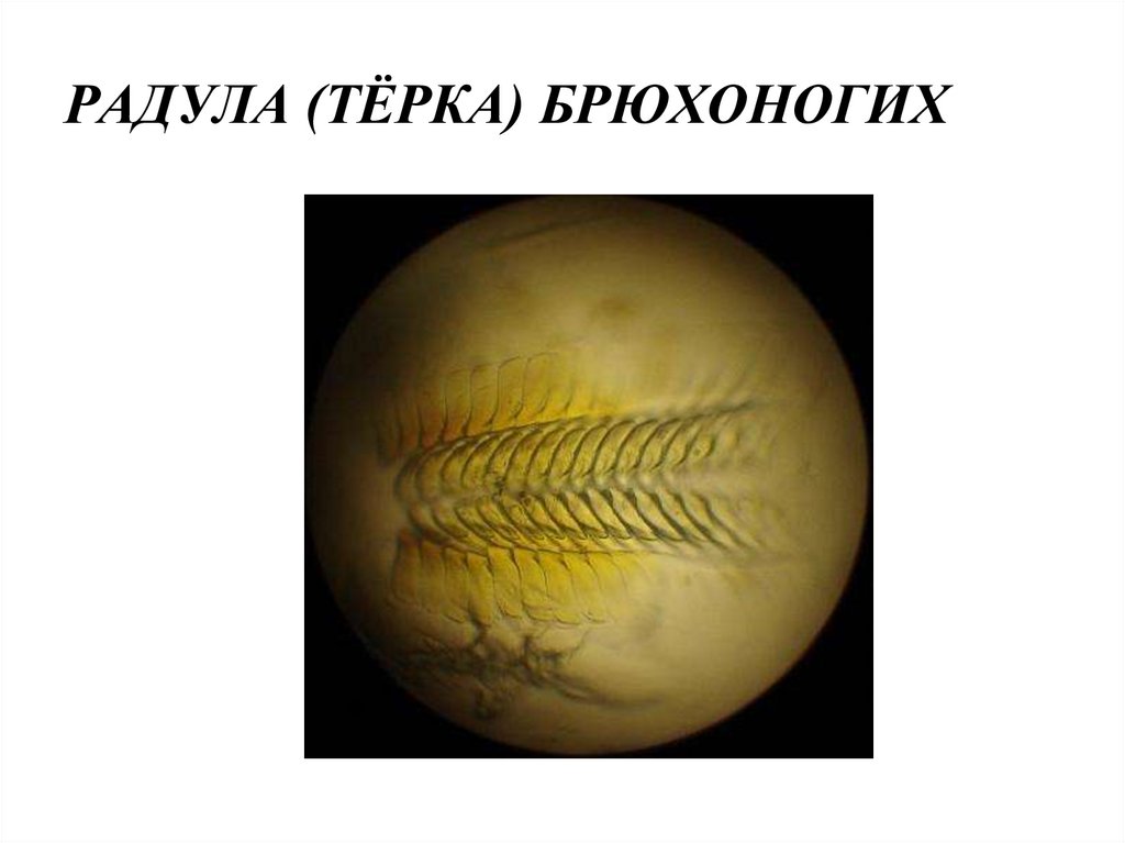РАДУЛА (ТЁРКА) БРЮХОНОГИХ