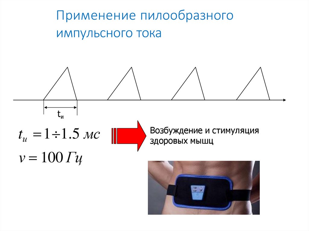Применение пилообразного импульсного тока