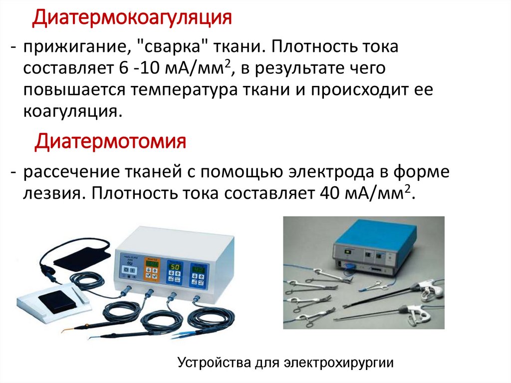 Диатермокоагуляция