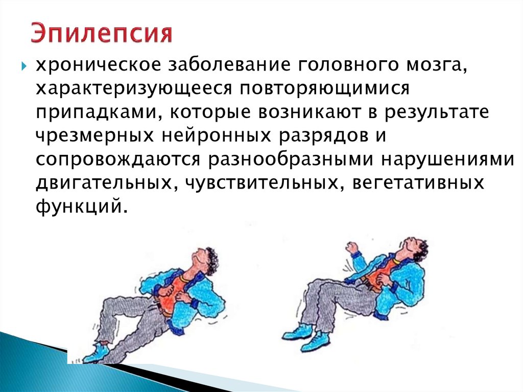 Эпилепсия