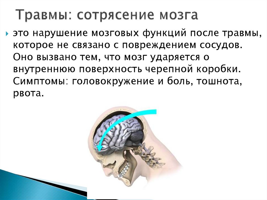 Травмы: сотрясение мозга