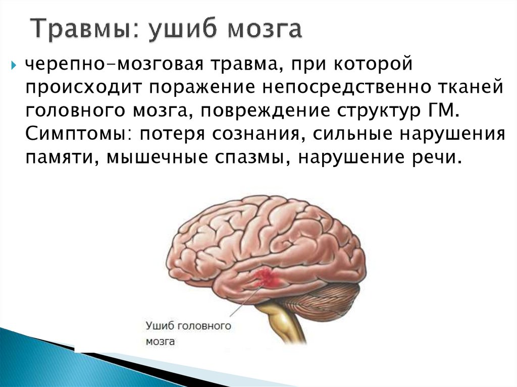 Травмы: ушиб мозга