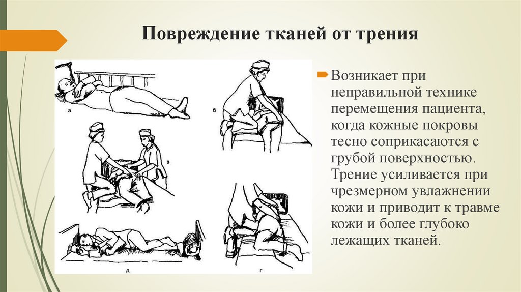 Повреждение тканей от трения