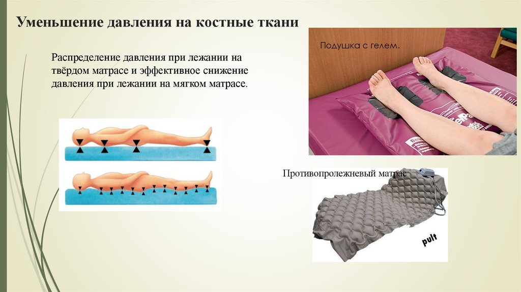 Уменьшение давления на костные ткани