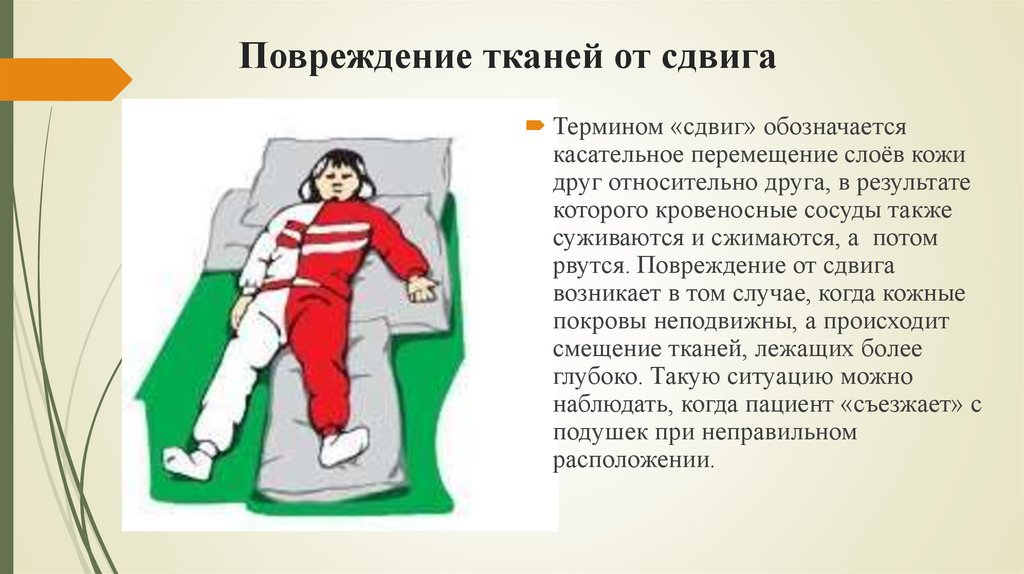 Повреждение тканей от сдвига