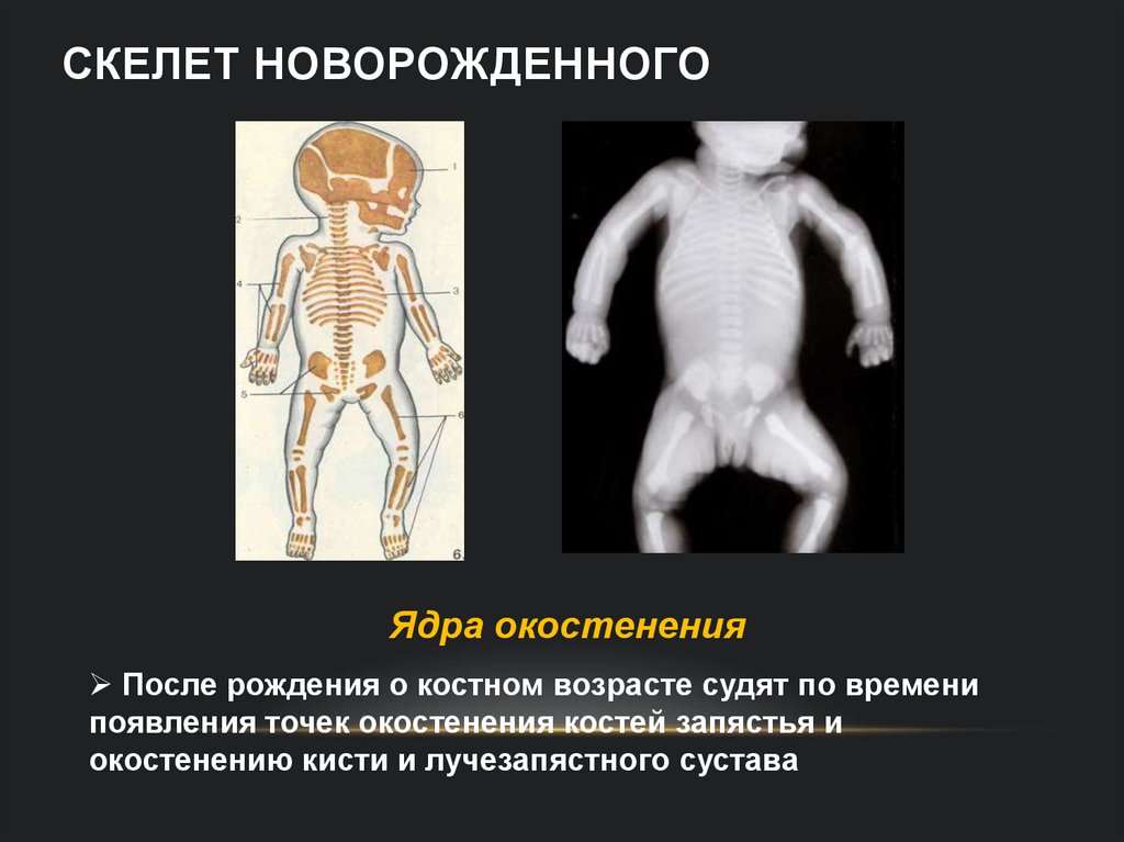 Скелет новорожденного