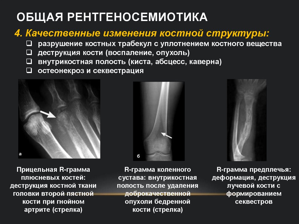 Общая рентгеносемиотика