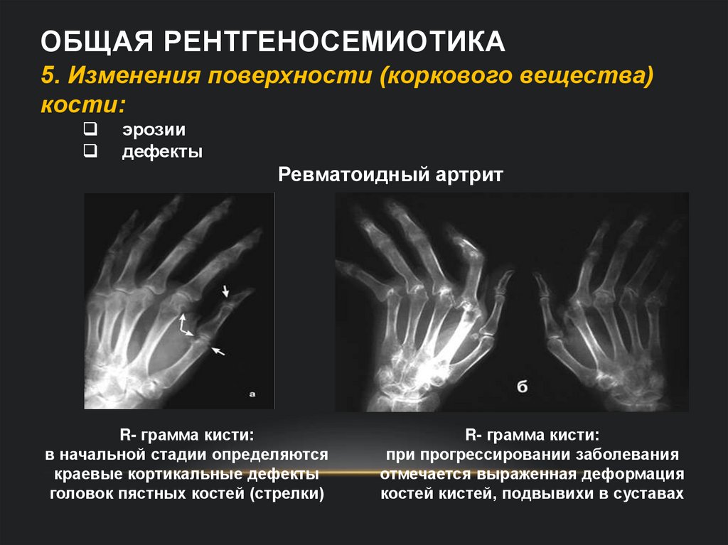 Общая рентгеносемиотика