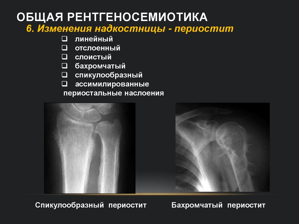 Общая рентгеносемиотика
