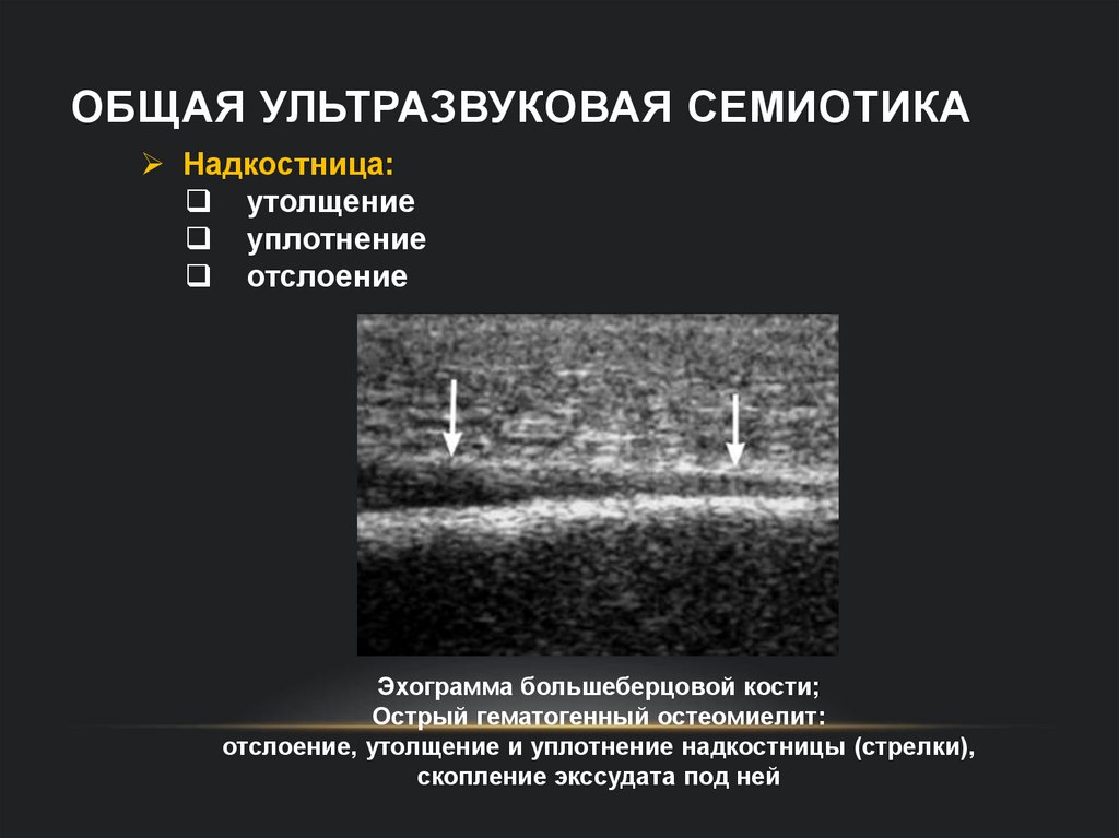 Общая ультразвуковая семиотика