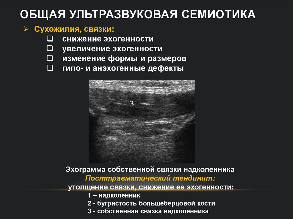 Общая ультразвуковая семиотика
