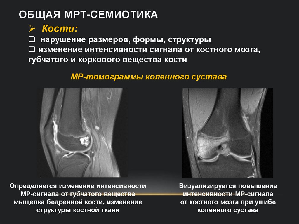 Общая МРТ-семиотика