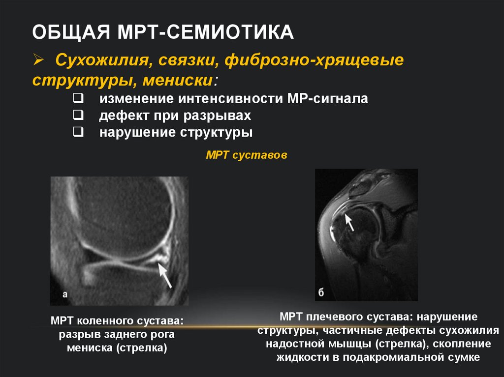 Общая МРТ-семиотика