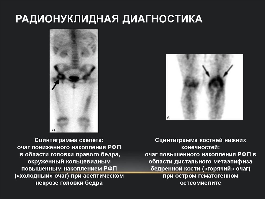 Радионуклидная диагностика