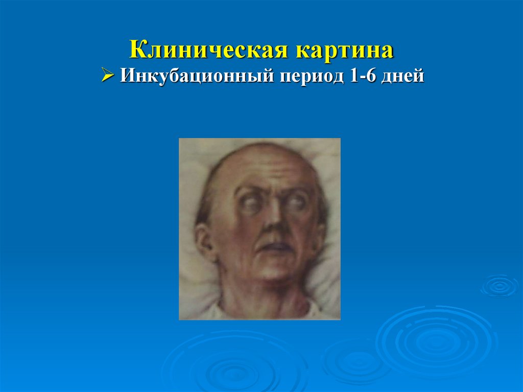 Клиническая картина