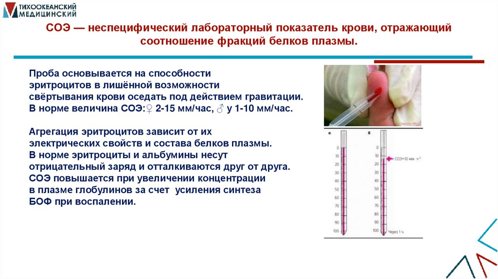 СОЭ — неспецифический лабораторный показатель крови, отражающий соотношение фракций белков плазмы.