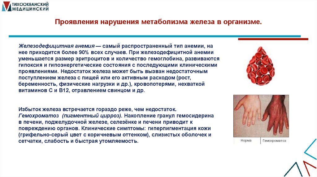 Проявления нарушения метаболизма железа в организме.