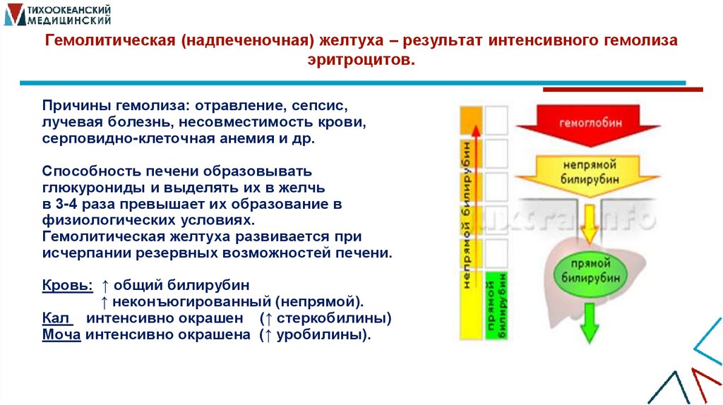 Гемолитическая (надпеченочная) желтуха – результат интенсивного гемолиза эритроцитов.