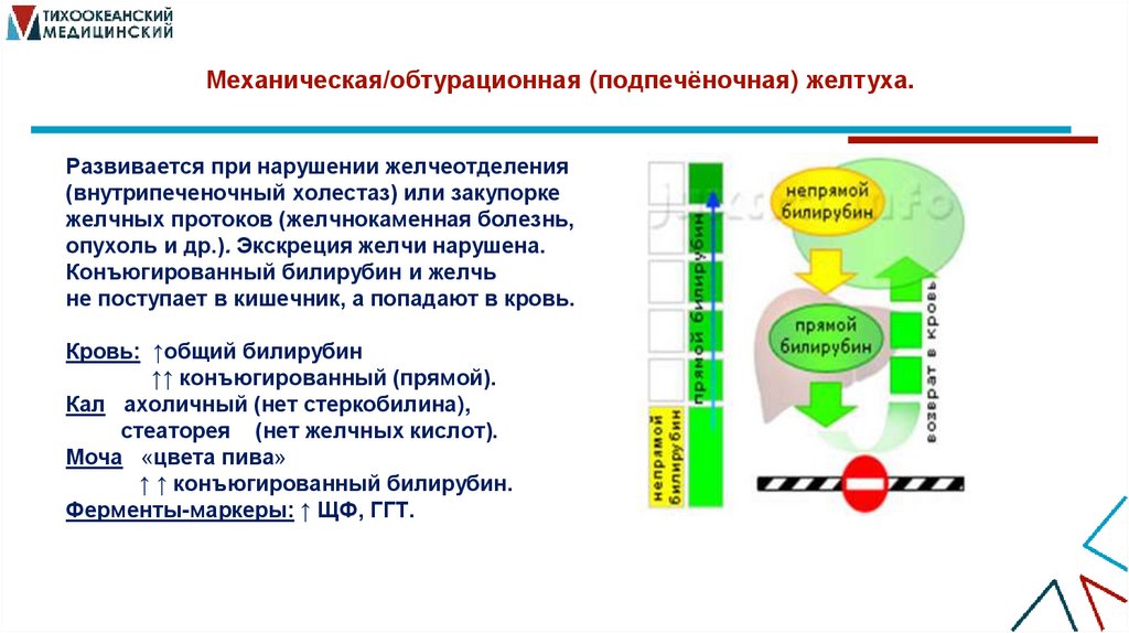 Механическая/обтурационная (подпечёночная) желтуха..