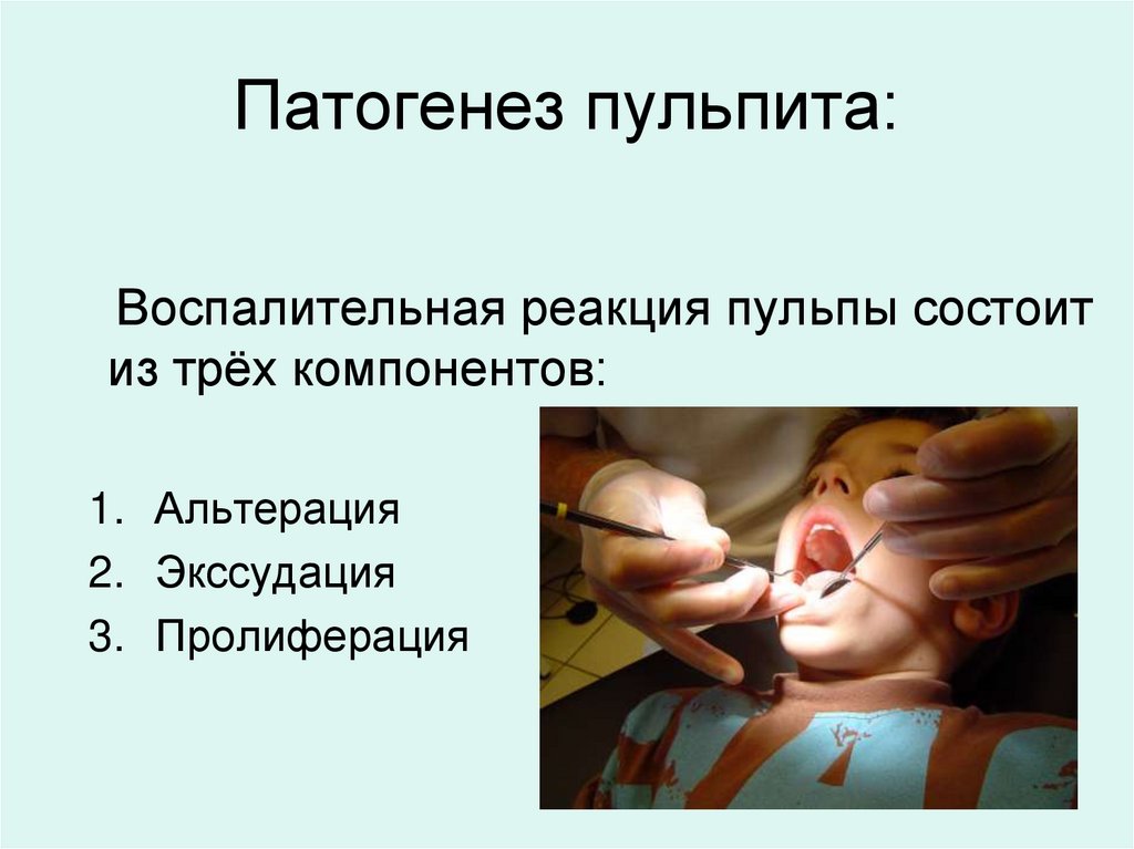 Патогенез пульпита: