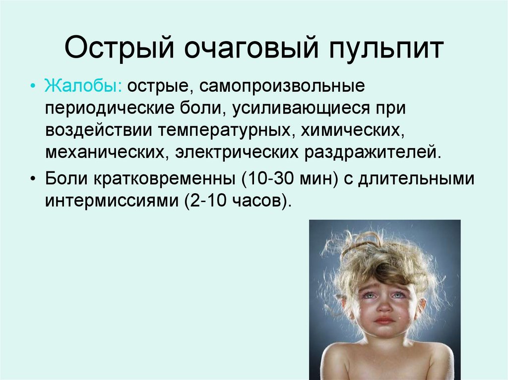 Острый очаговый пульпит