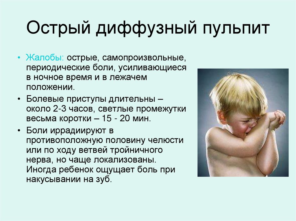 Острый диффузный пульпит