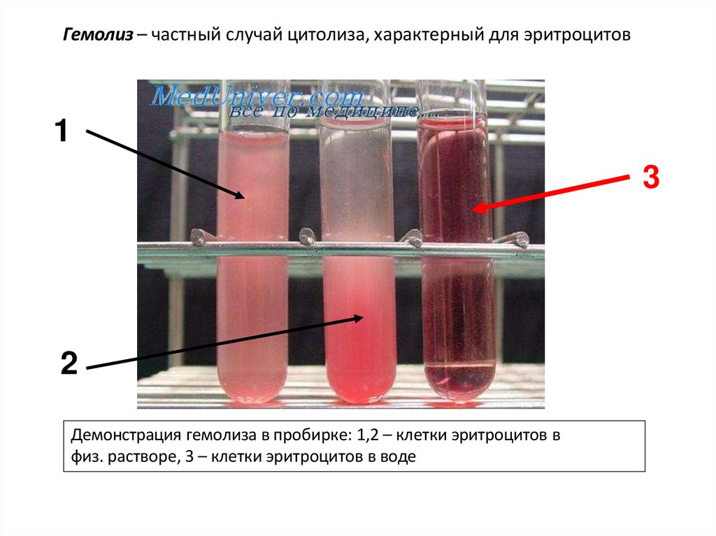 Гемолиз – частный случай цитолиза, характерный для эритроцитов