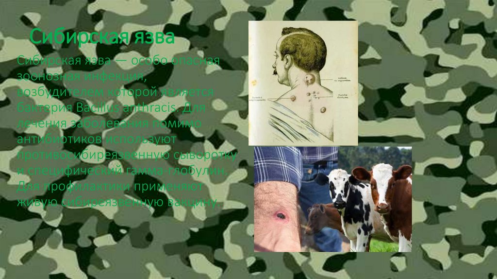 Сибирская язва
