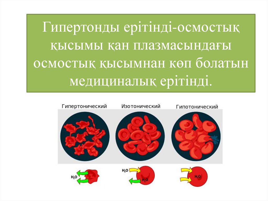 Гипертонды ерітінді-осмостық қысымы қан плазмасындағы осмостық қысымнан көп болатын медициналық ерітінді.